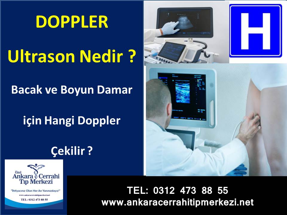 renkli dopler ultrason ankara