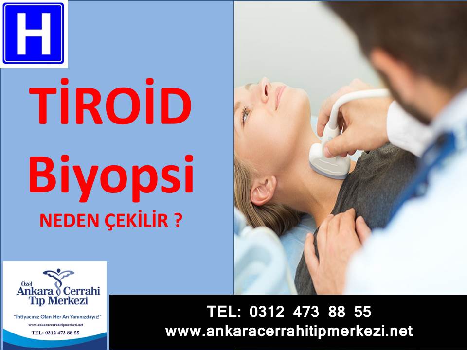 Tiroid Biyopsi Ankara